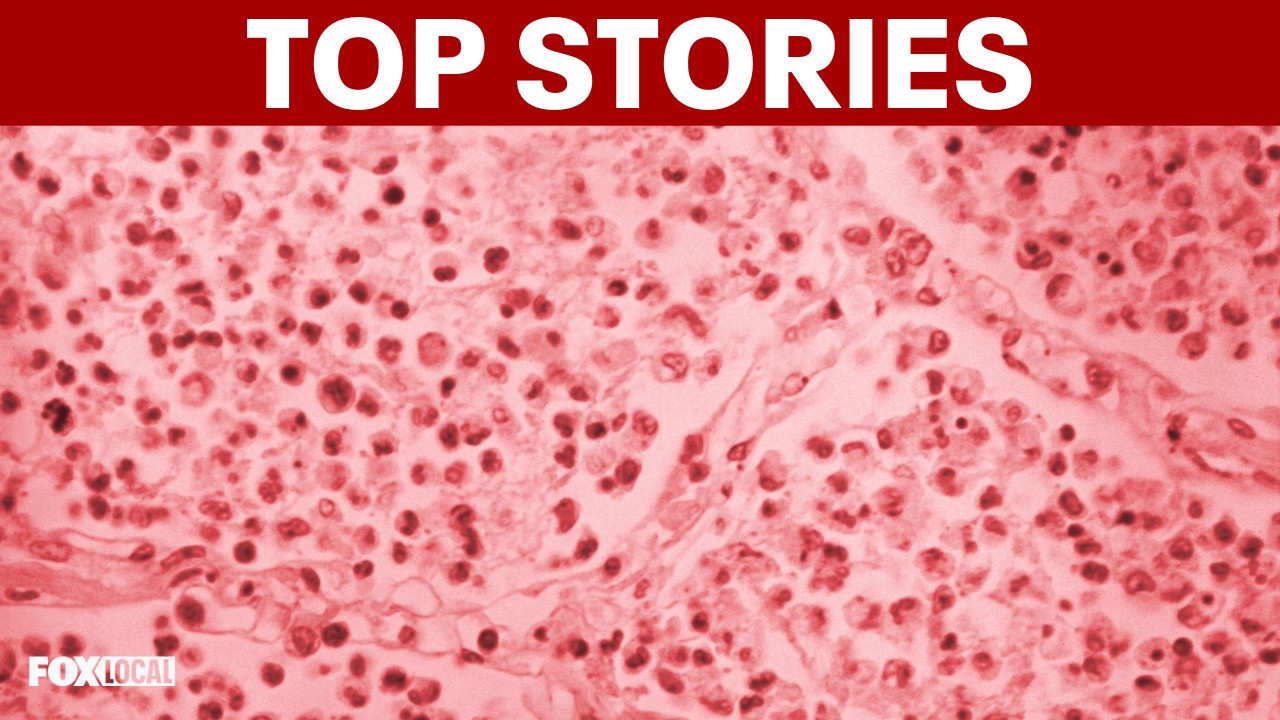 Video thumbnail for TOP STORIES | Upper East Side Legionnaires outbreak grows; US-Iran talks resume; weekend weather