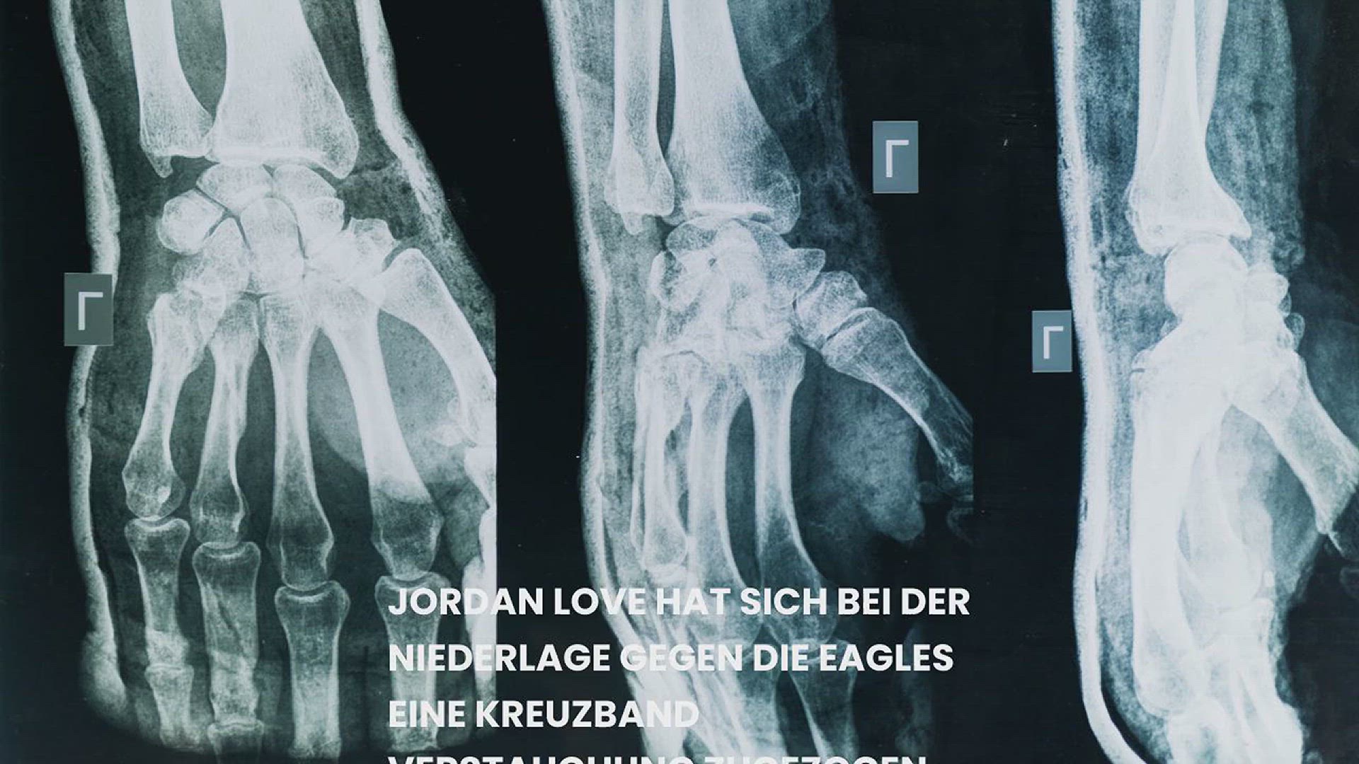 'Video thumbnail for Entwarnung: Jordan Love entgeht schwerer Verletzung – 3-4 Wochen Pause'