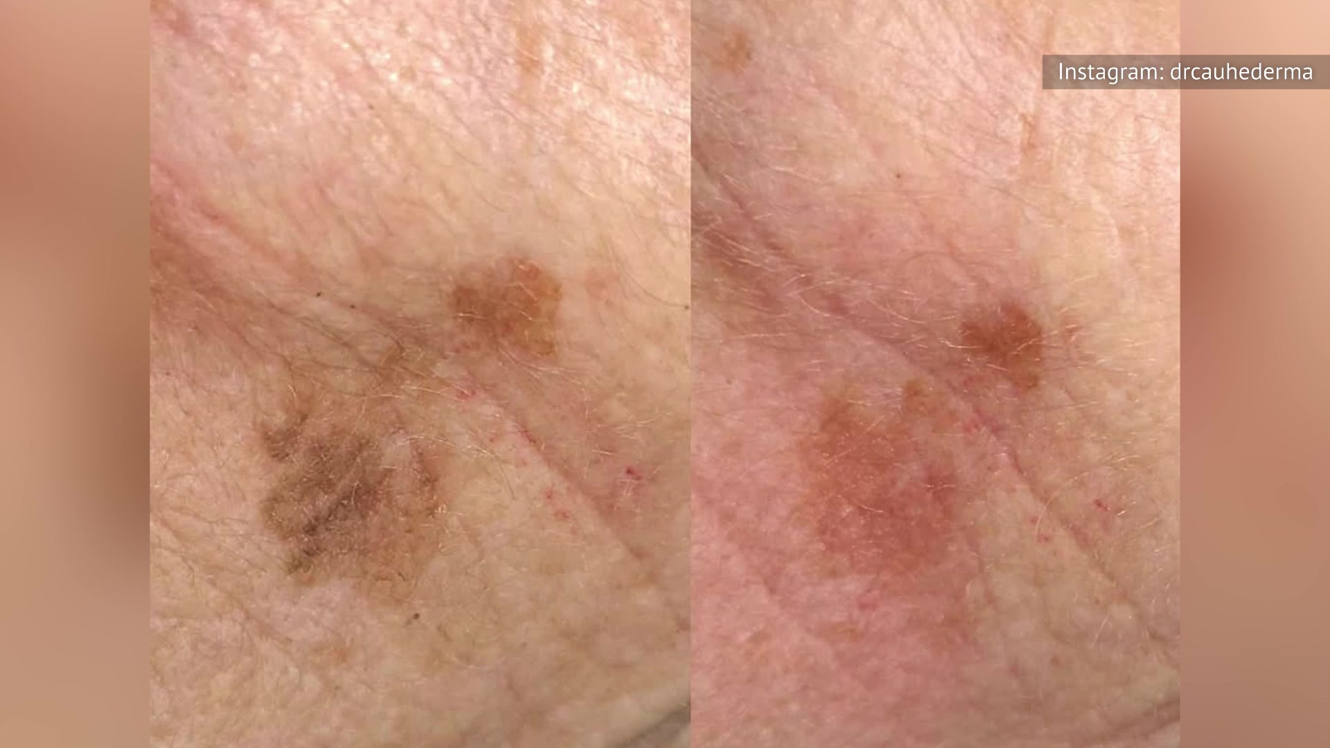 Video thumbnail for What Happens To Your Body When You Stop Showering?