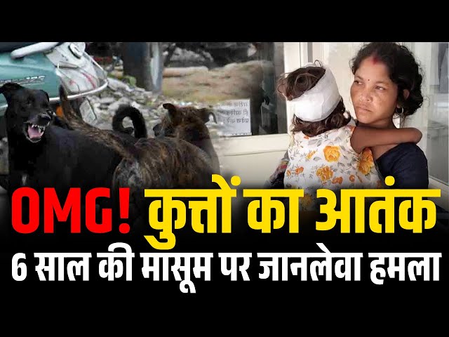 Video thumbnail for जबलपुर में आवारा कुत्तों का कहर, 6 साल की मासूम पर किया हमला 🐕😱