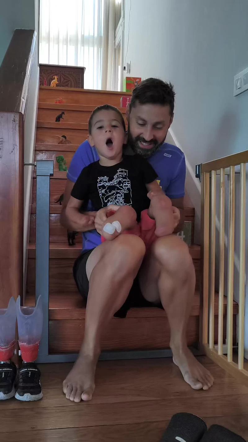 Video thumbnail for Little Boy with Prosthetic Legs Conquers the Stairs with Dad
