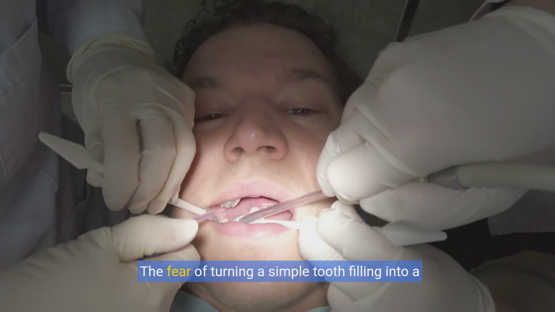 'Video thumbnail for Navigating Dental Care: Saving on Tooth Fillings Without Insurance'