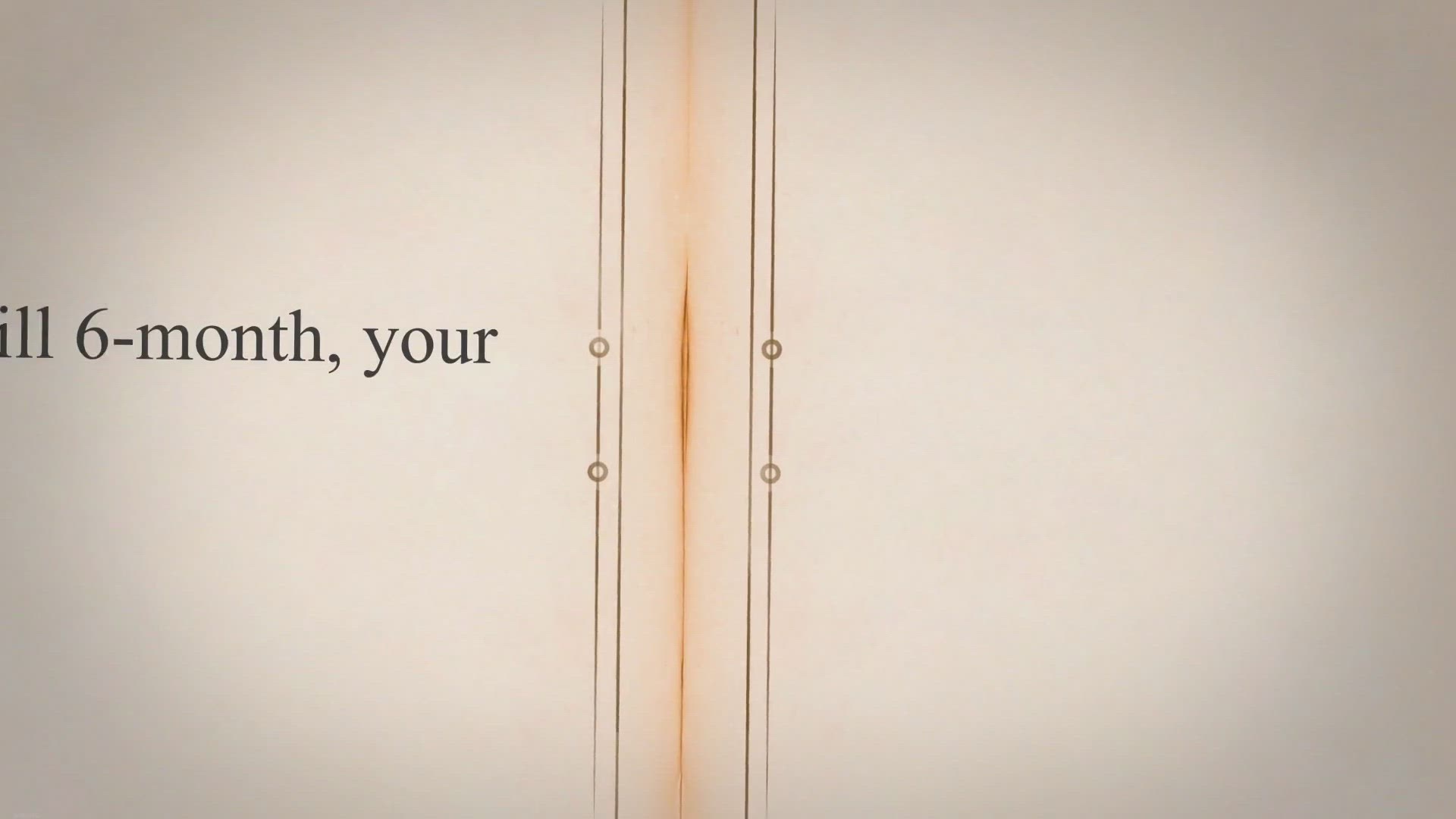 Video thumbnail for How Much Banana Can A 8 Month Old Eat? | Benefits And Precautions