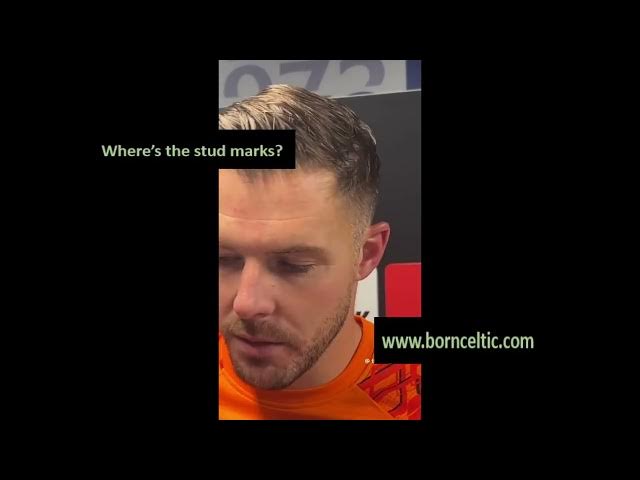 Video thumbnail for Billy Dodds' looks like a fool with his Celtic meltdown over Jack Butland