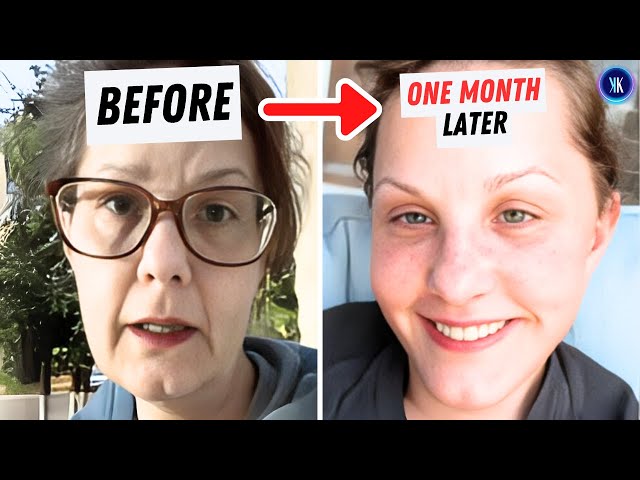 Video thumbnail for She Found The World's Best Surgeon In Mexico