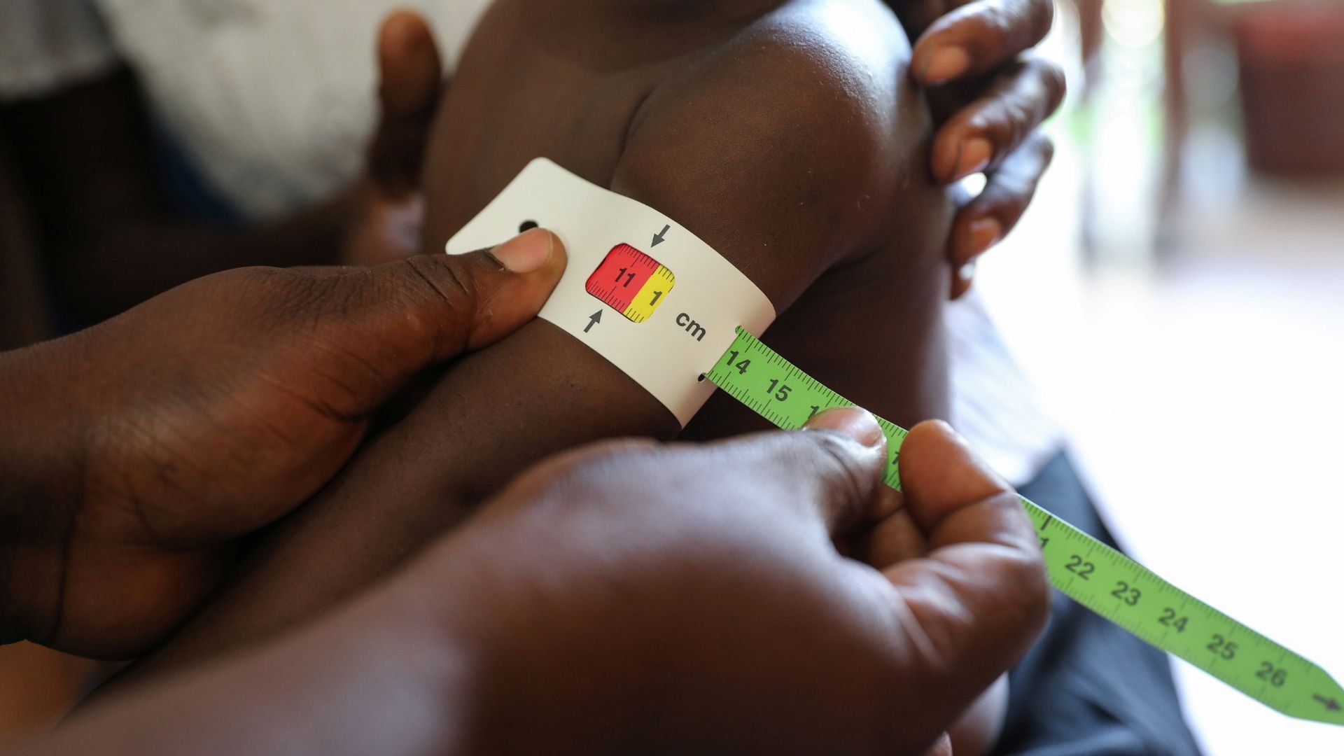 Video thumbnail for Haiti hunger crisis deepens as 1 in 13 children is severely malnourished