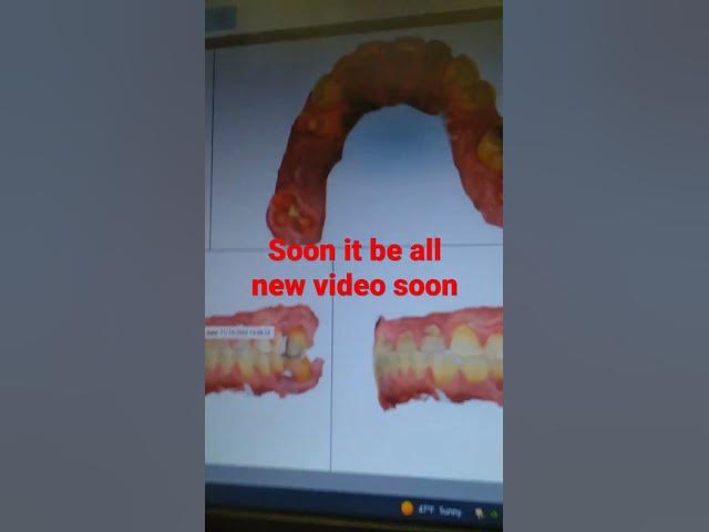 Video thumbnail for brand new