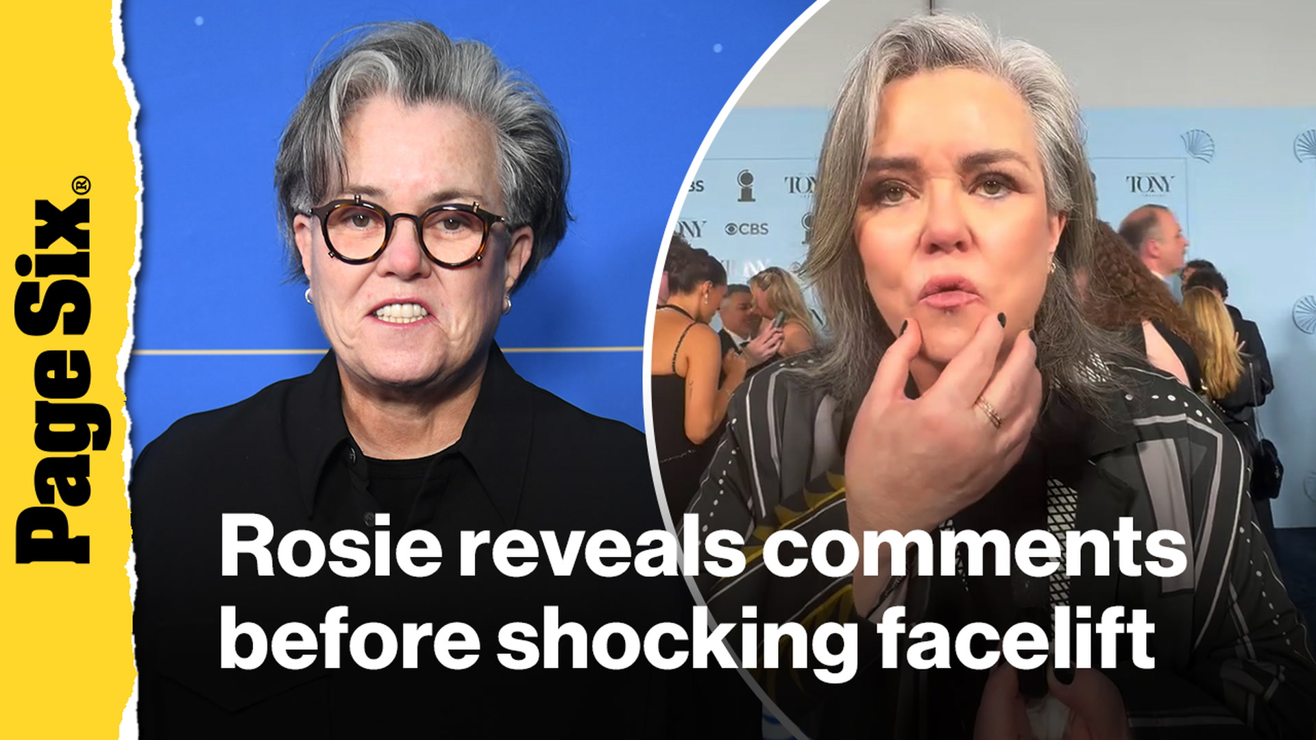 Video thumbnail for Rosie O'Donnell reveals awkward comments she received about her looks before shocking facelift