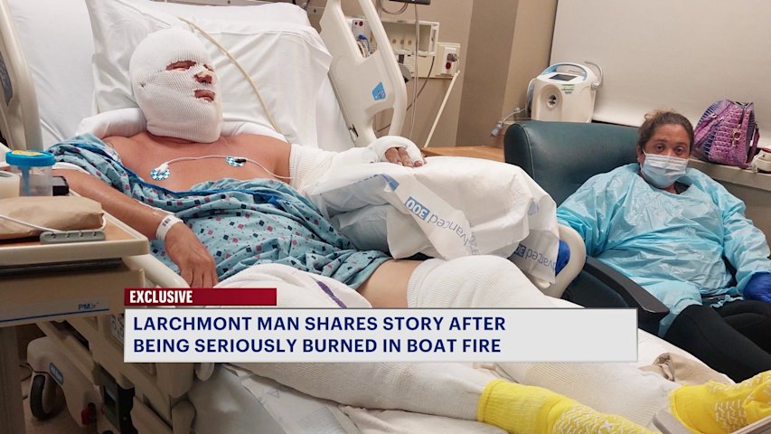 Video thumbnail for ‘I didn’t think I’d be here.’ Burn victim speaks out after Mamaroneck boat fire