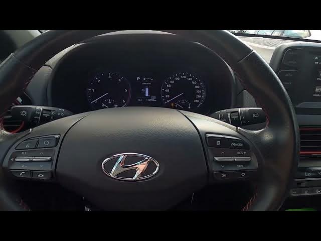 Video thumbnail for How to Enter and Manage Digital Speedometer in Hyundai Kona ( 2017 – now )