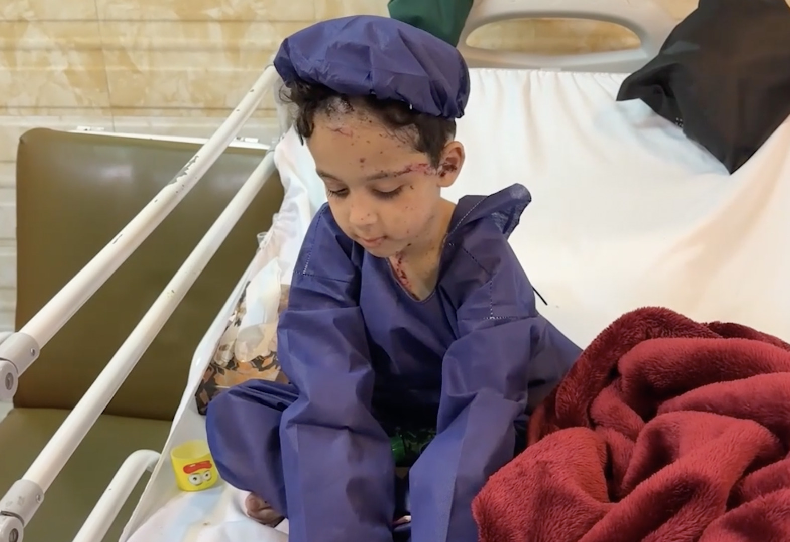 Video thumbnail for Children wounded in the US-Israeli strikes receive treatment at Mofid Children's Hospital in Tehran