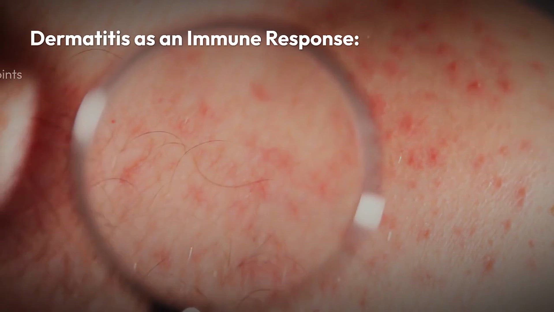 Video thumbnail for Vitamin_D_and_Skin_Health_Insight