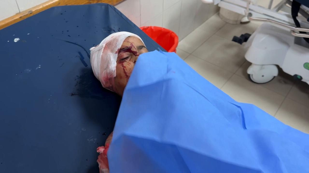 Video thumbnail for Palestinians killed, wounded after Israeli strike hits tent camp in southern Gaza.