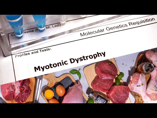 'Video thumbnail for Can a carnivore diet help with myotonic dystrophy'