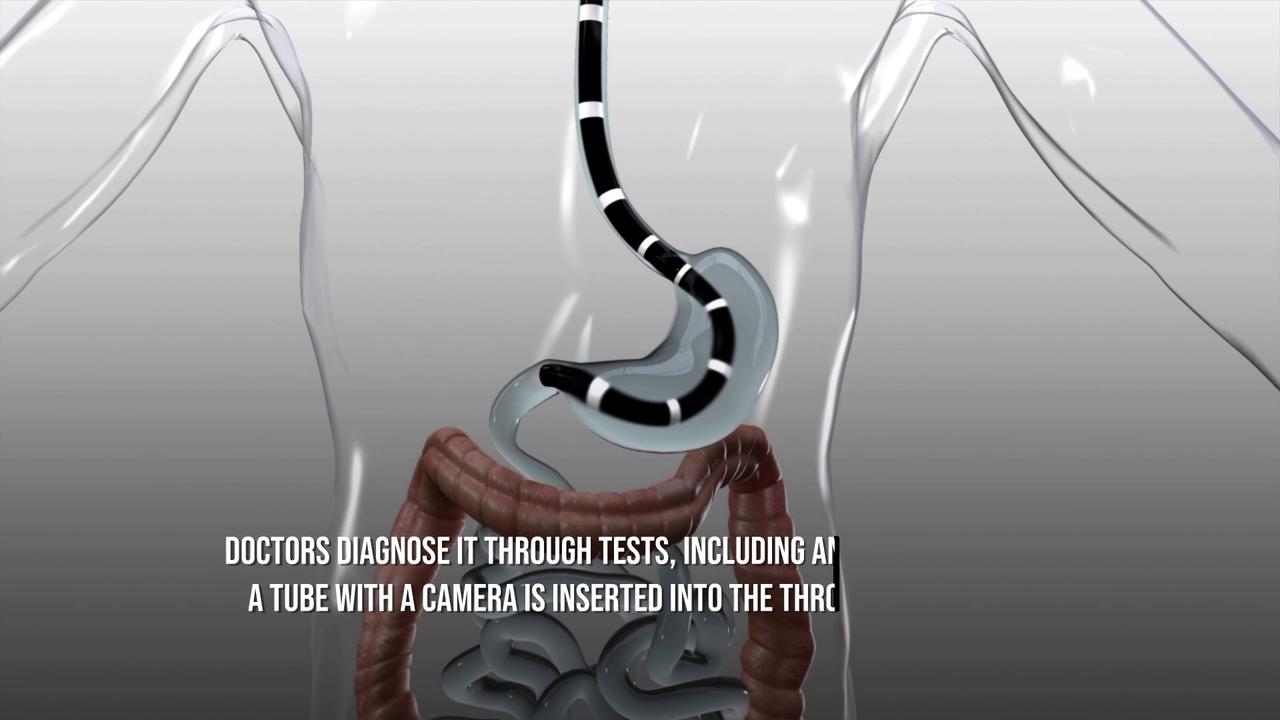 Video thumbnail for Kim Kardashian diagnosed with oesophagitis.