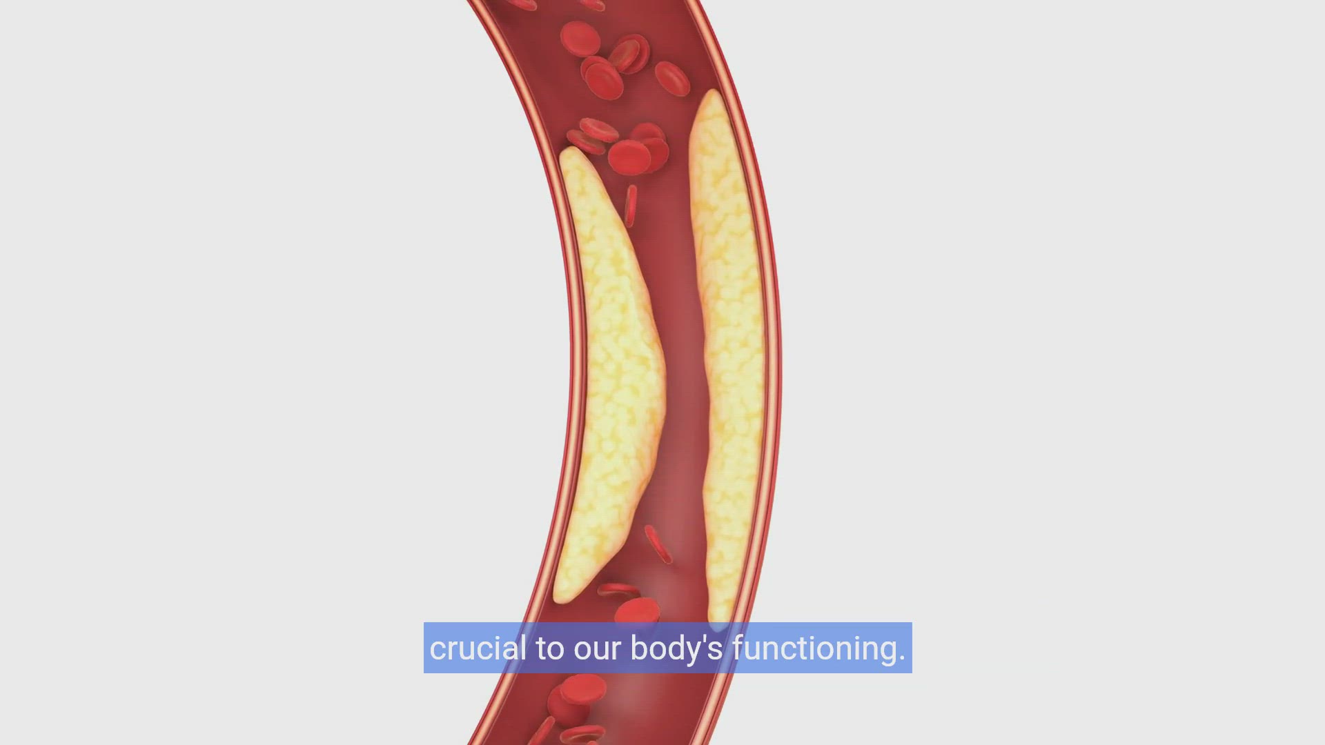 'Video thumbnail for Unlock Heart Health:Natural Ways to Lower Cholesterol'
