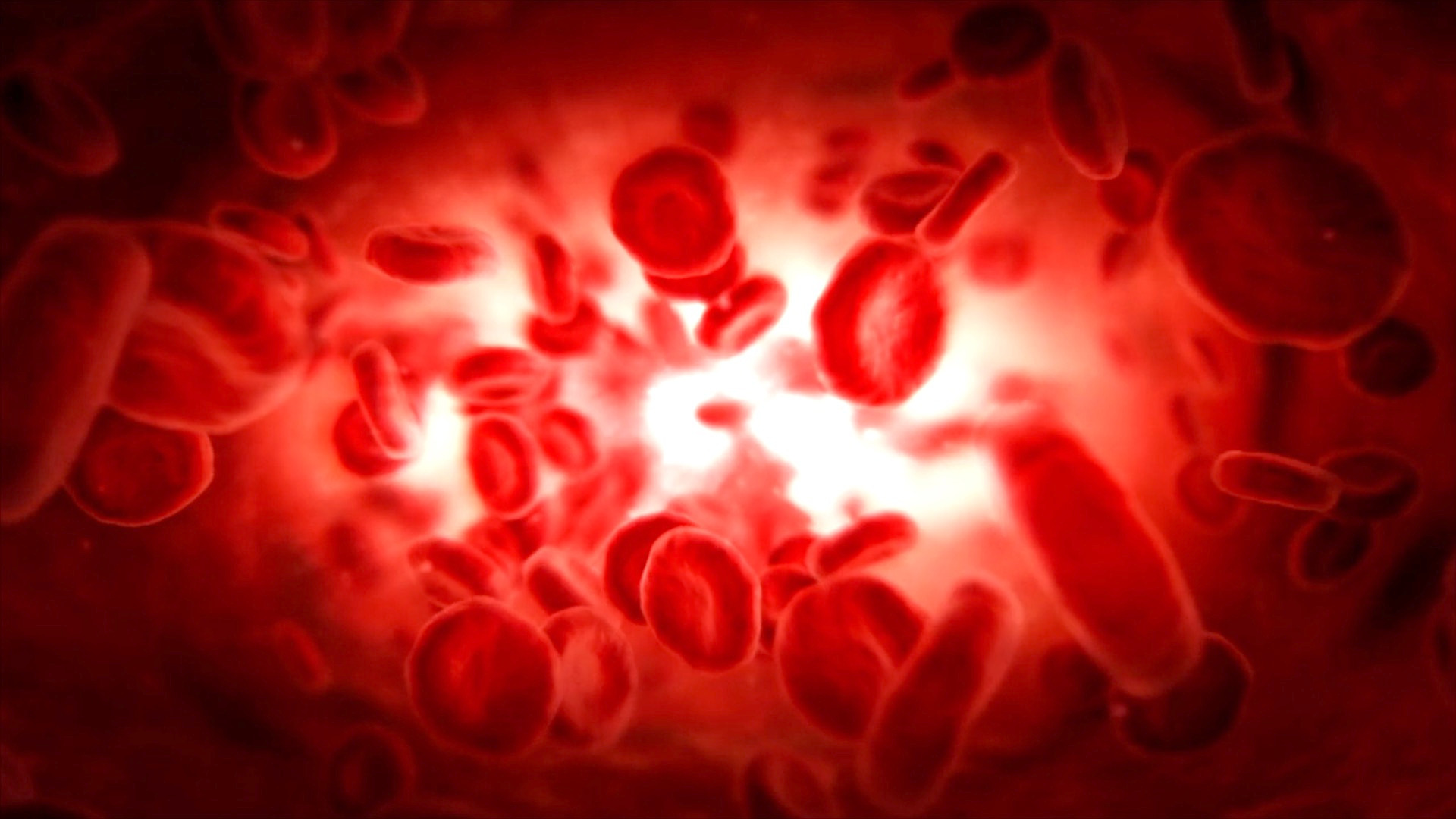 Video thumbnail for Microplastics Found in Most Arterial Plaques, Study Finds