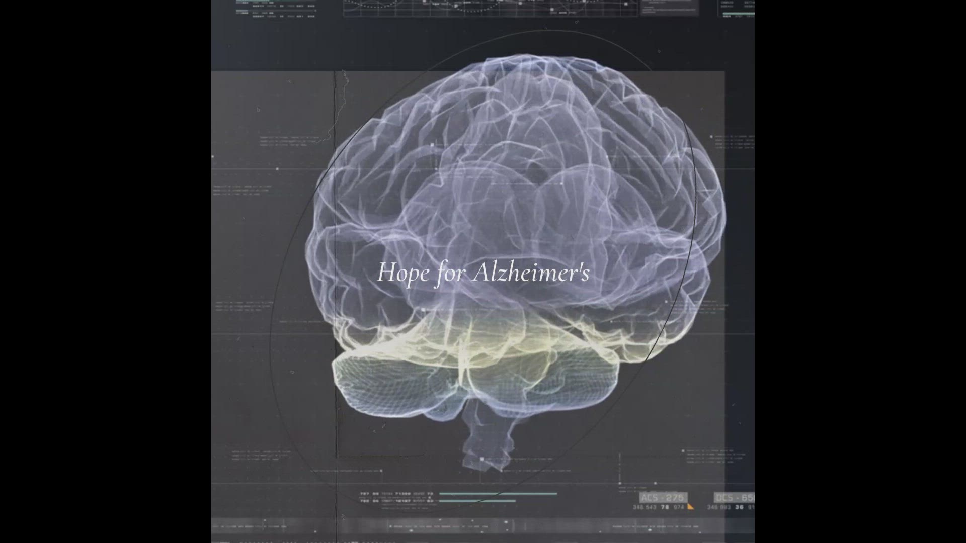 'Video thumbnail for Alzheimer treatment'