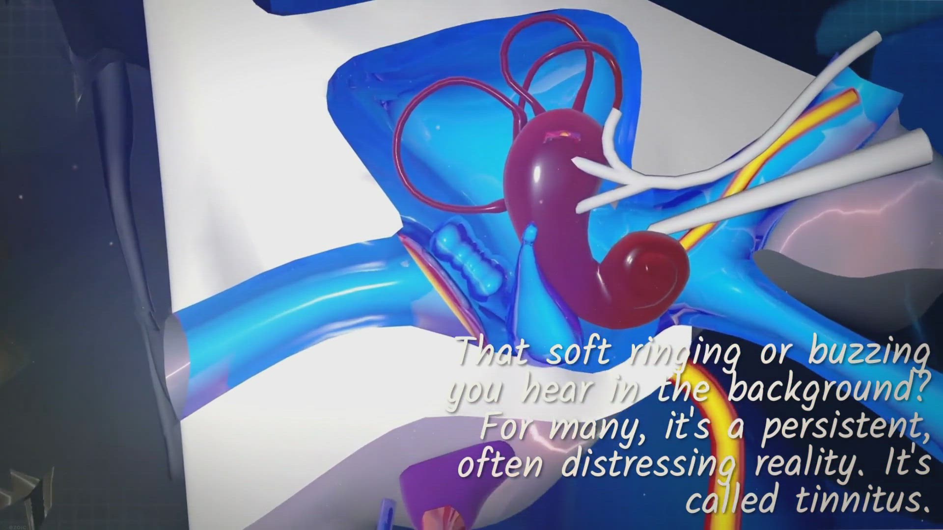 Video thumbnail for 8 Causes of Tinnitus