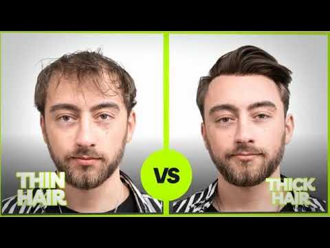 Video thumbnail for Thin Hair vs Thick Hair in Males: How to Tell the Difference