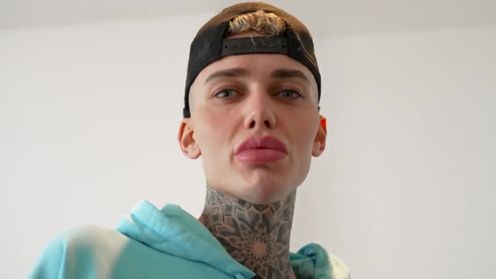 'Video thumbnail for I Convinced My Boyfriend To Get Surgery With Me | LOVE DON'T JUDGE'