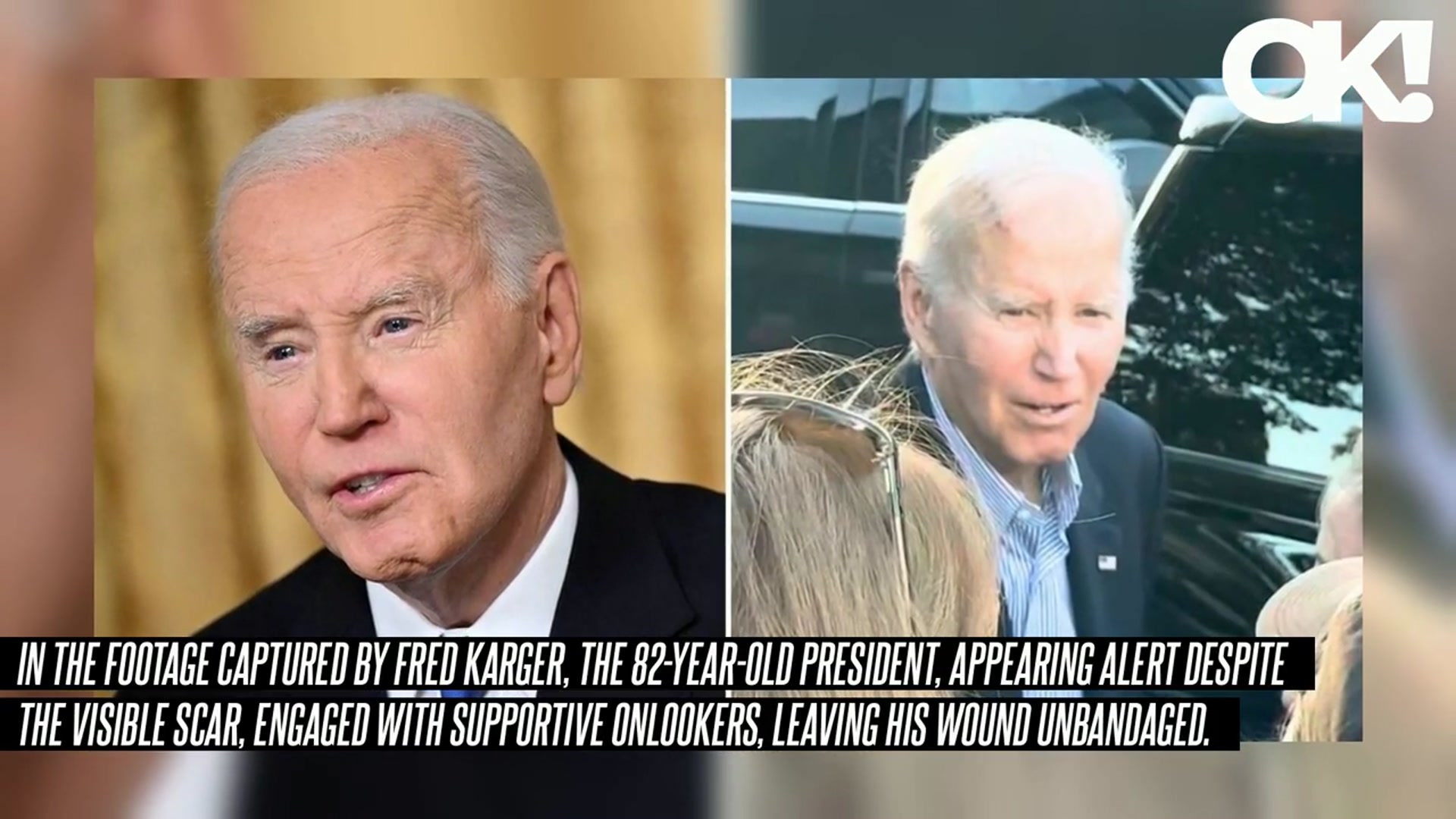 'Video thumbnail for Joe Biden, 82, Seen With Gash on His Forehead After Undergoing Surgery to Remove Skin Cancer'