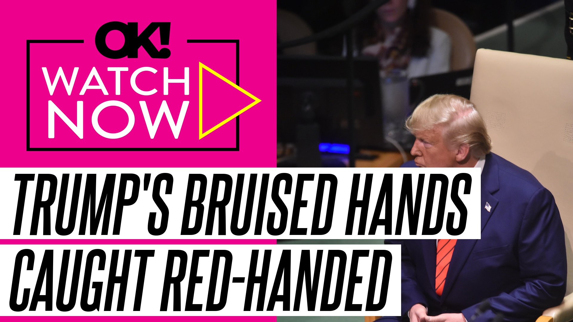 Video thumbnail for Donald Trump Fails to Hide His Bruised Hands as President Ends Government Shutdown in Oval Office: Photos