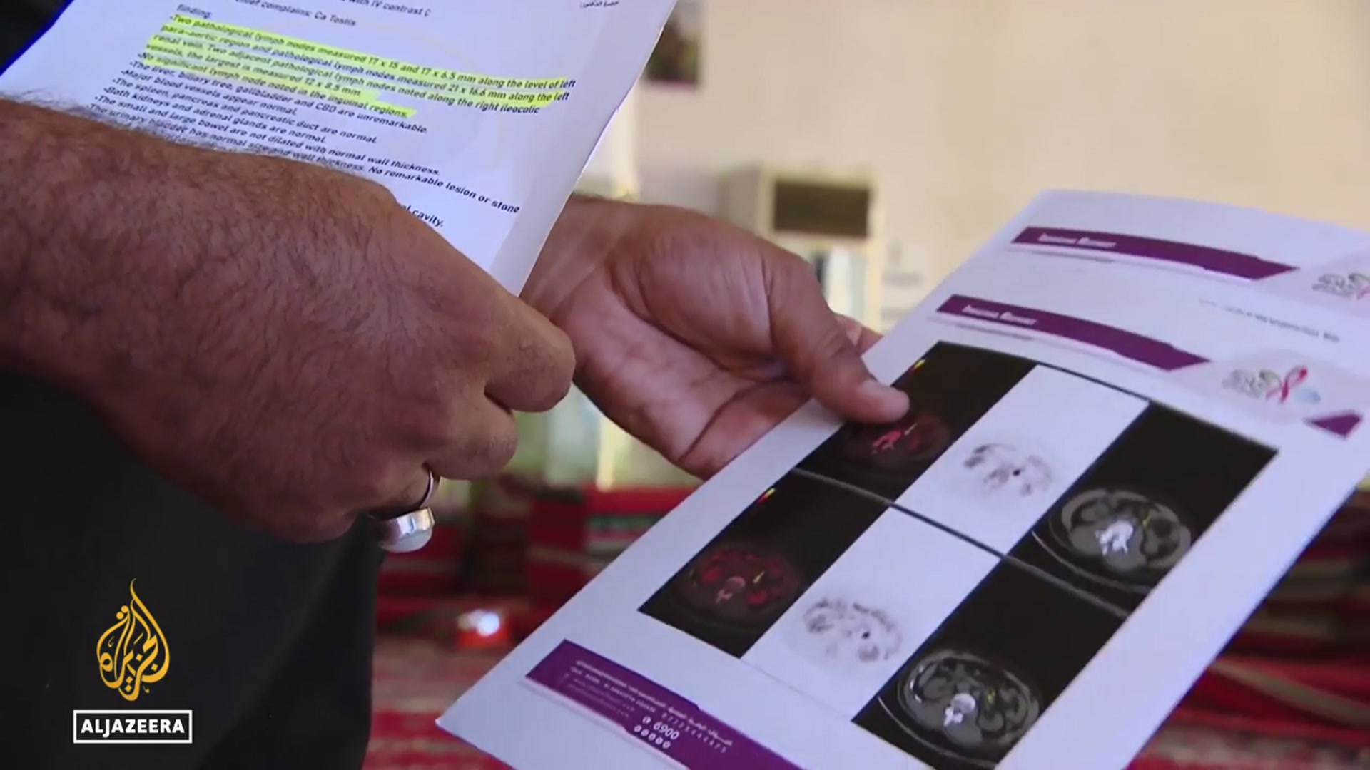 'Video thumbnail for Iraq oil pollution: Toxic emissions cause cancer'