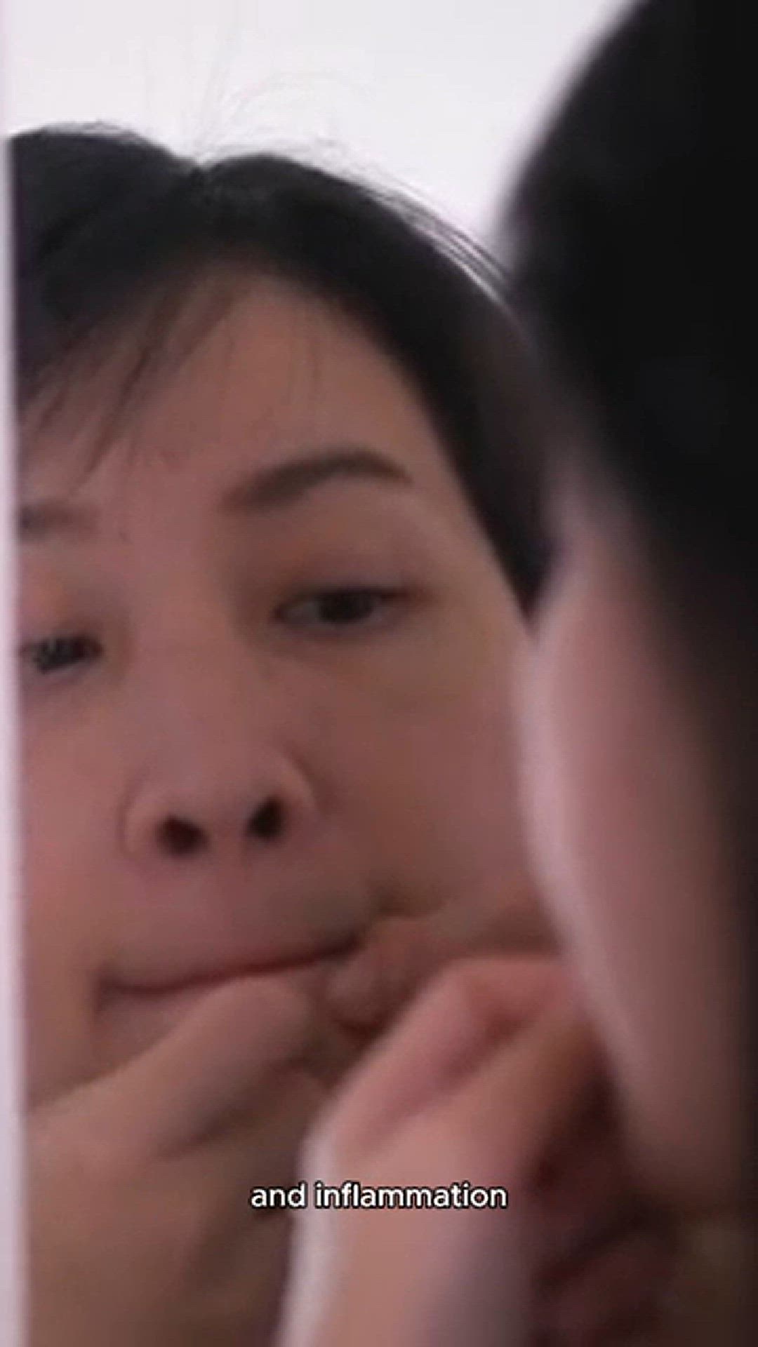 Video thumbnail for Tips for acne removal