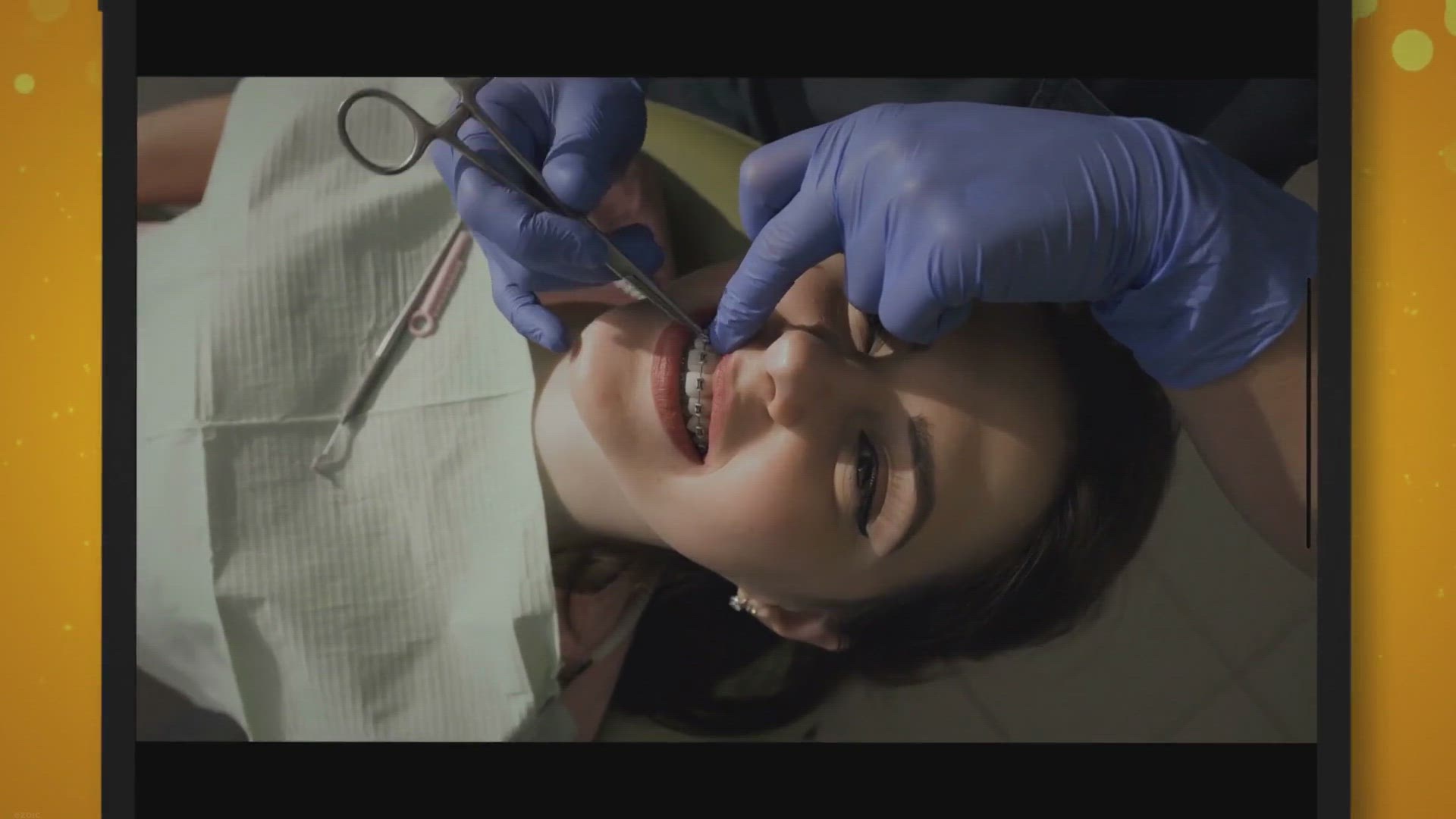 Video thumbnail for Smile mit Stil: 7 Zahnpflege-Tipps für Zahnspangenträger