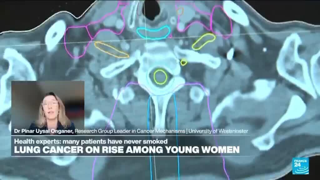 'Video thumbnail for Why are lung cancer rates rising among young, fit women who have never smoked?'