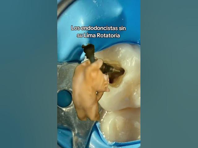 Video thumbnail for Solo es parecido a la realidad!Descubre nuestra Linea de endodoncia! #endodoncia #bondent #dental