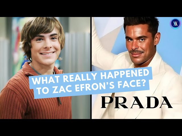 Video thumbnail for Zac Efron’s Face Transformation: Accident, Rumors & The Truth
