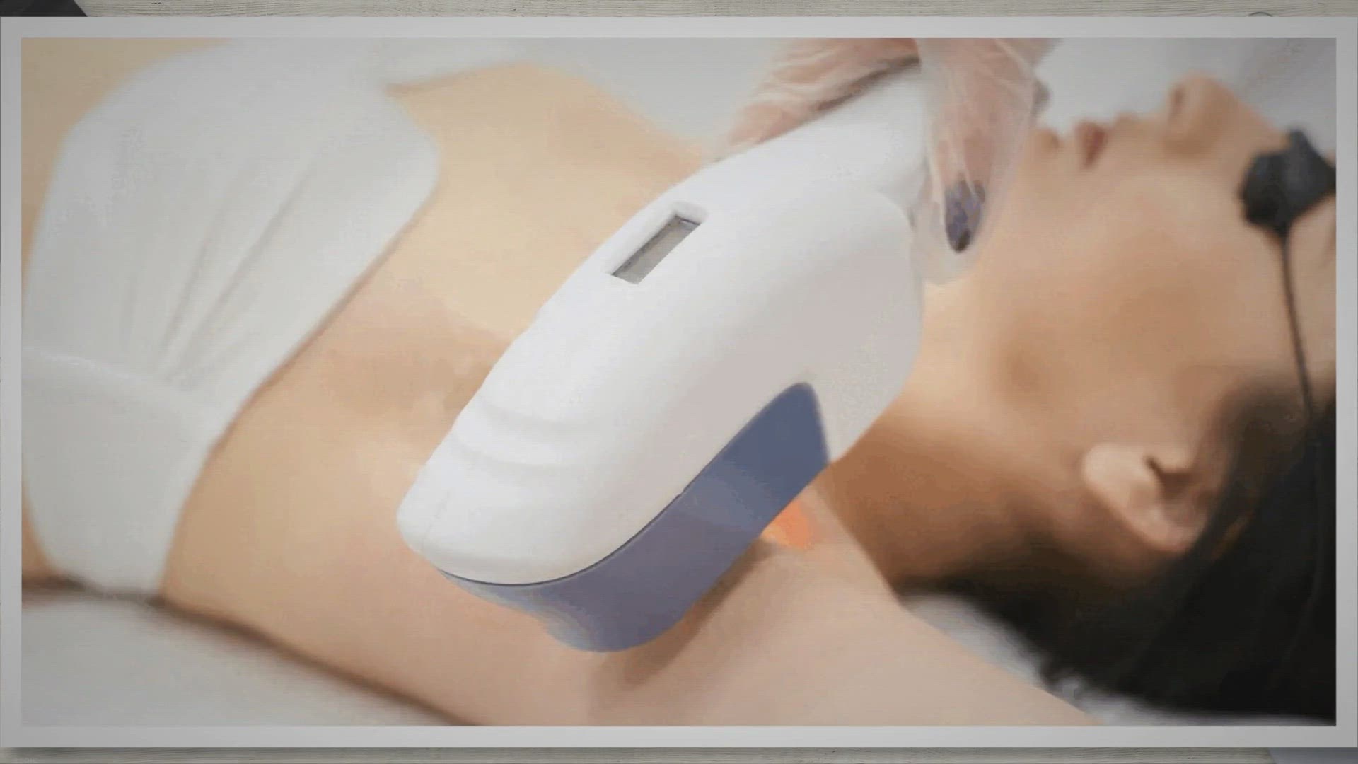 Video thumbnail for How to Start a Laser Hair Removal Business? [An Ultimate Guide]