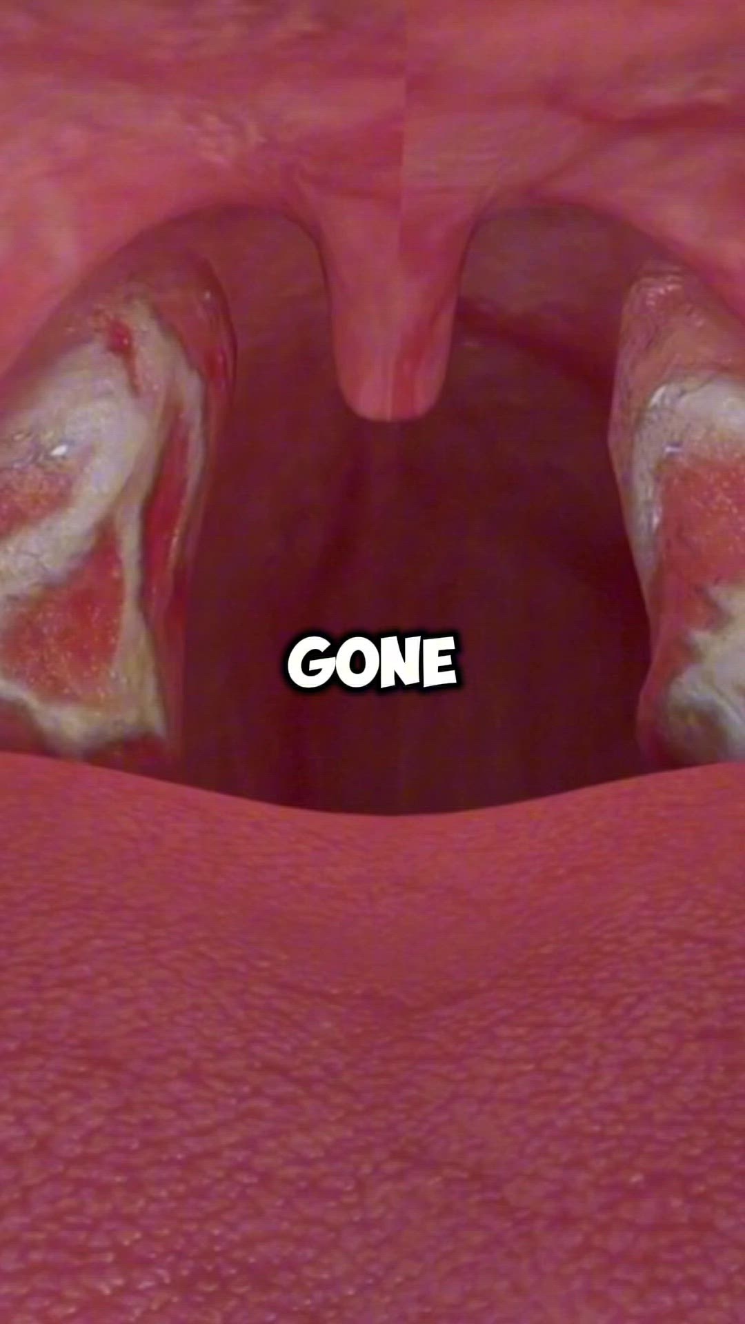 Video thumbnail for Healthy lungs / Prevent Halitosis