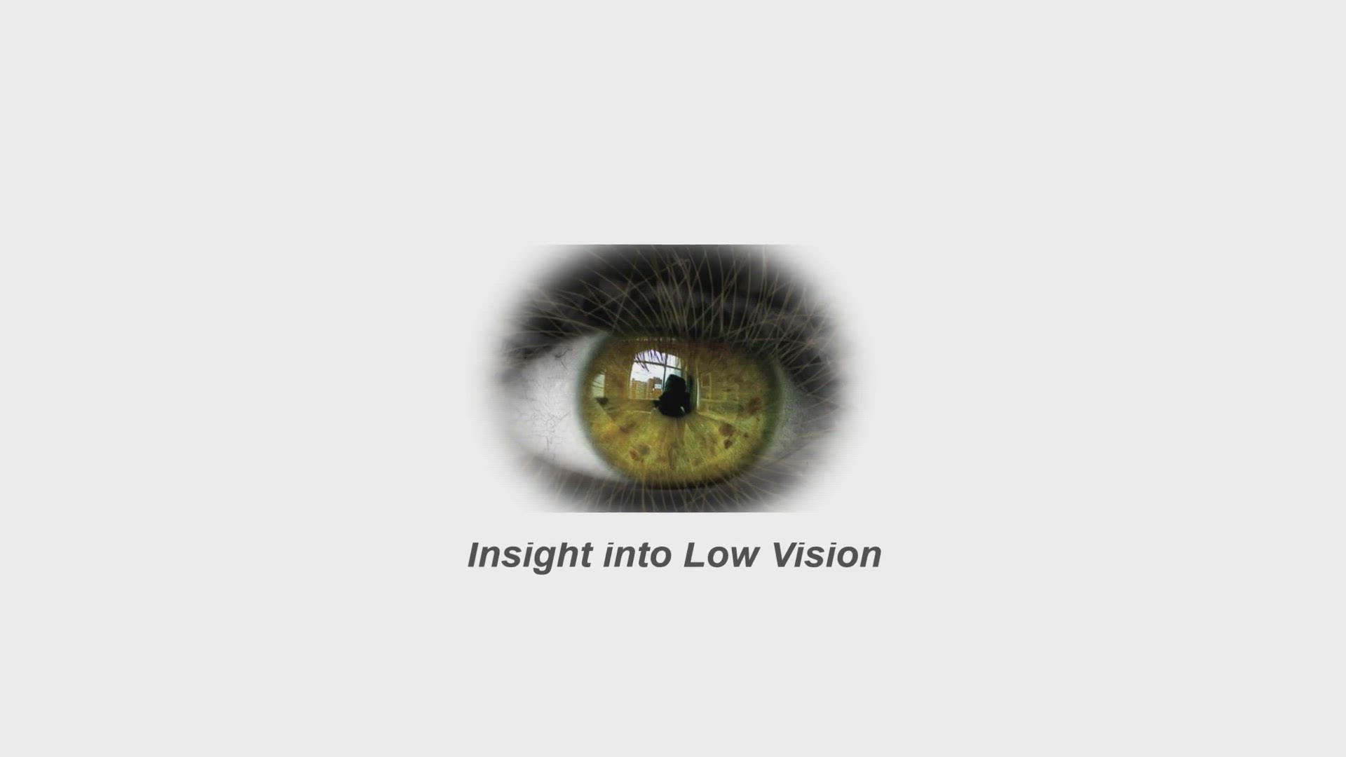 Video thumbnail for What are the Types of Vision Loss?