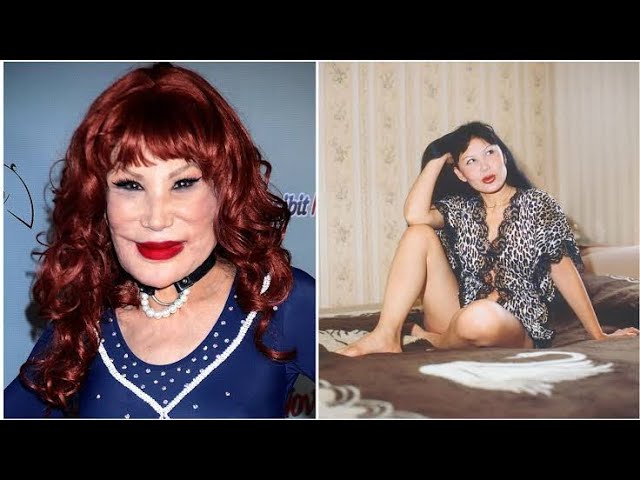 Video thumbnail for Who is Lyn May and what surgery has she done? | Bio, Age, Husband