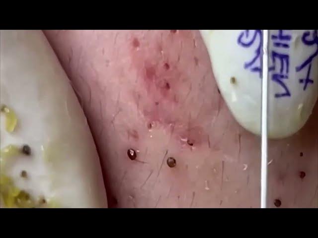 Video thumbnail for ππππππ‘ πΎπ‘πππ£π¨ππ£π Relax Every Day SacDepSpa Hours #100005