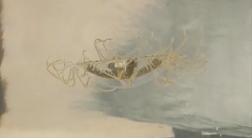 Video thumbnail for Six-year-old girl stung in Ocean County and hospitalized by invasive clinging jellyfish
