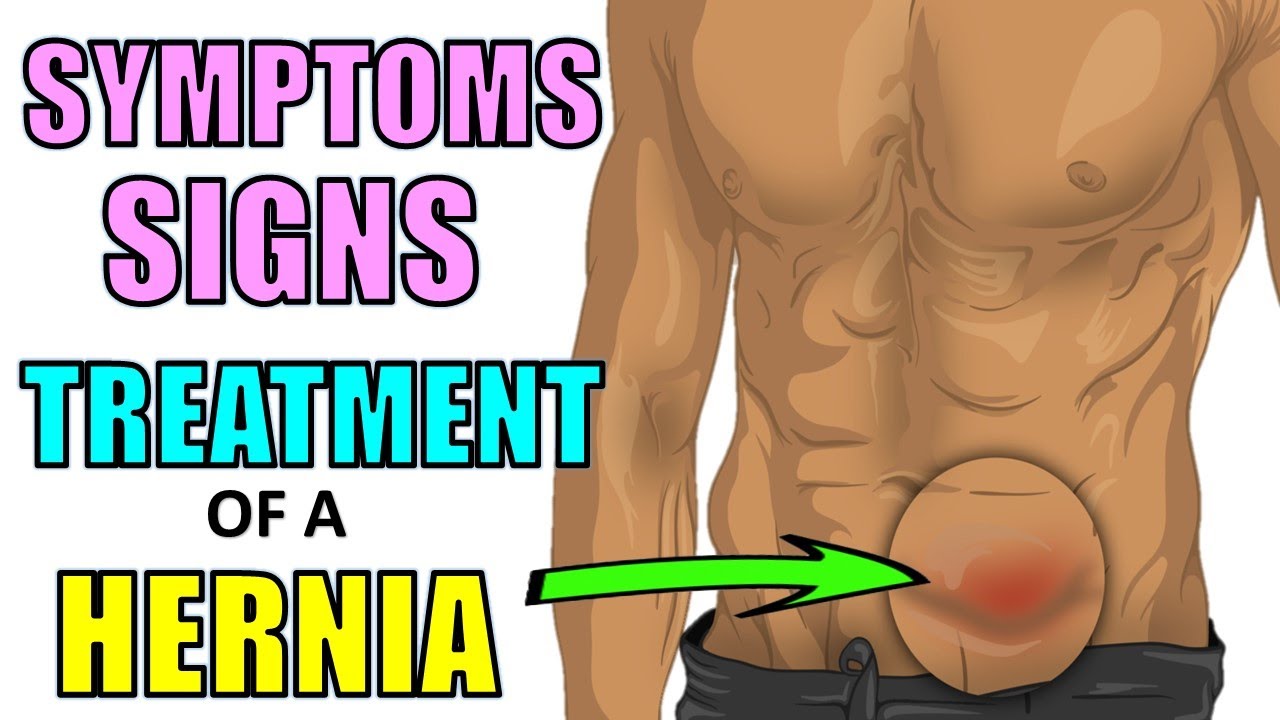 Video thumbnail for Signs &  Symptoms of a Hernia | Home Treatments of Hernias