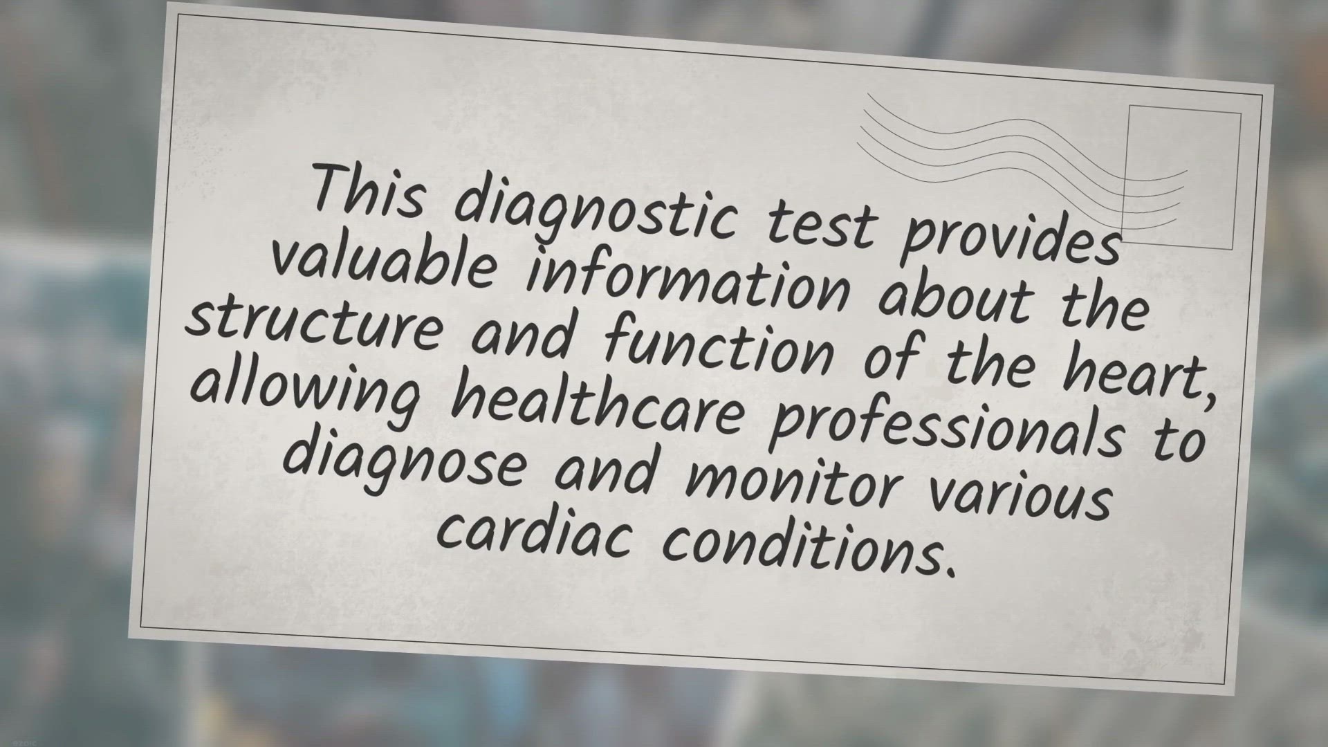 Video thumbnail for Exploring the World of Cardiac Sonography: Understanding the Procedure, Benefits, and Expectations