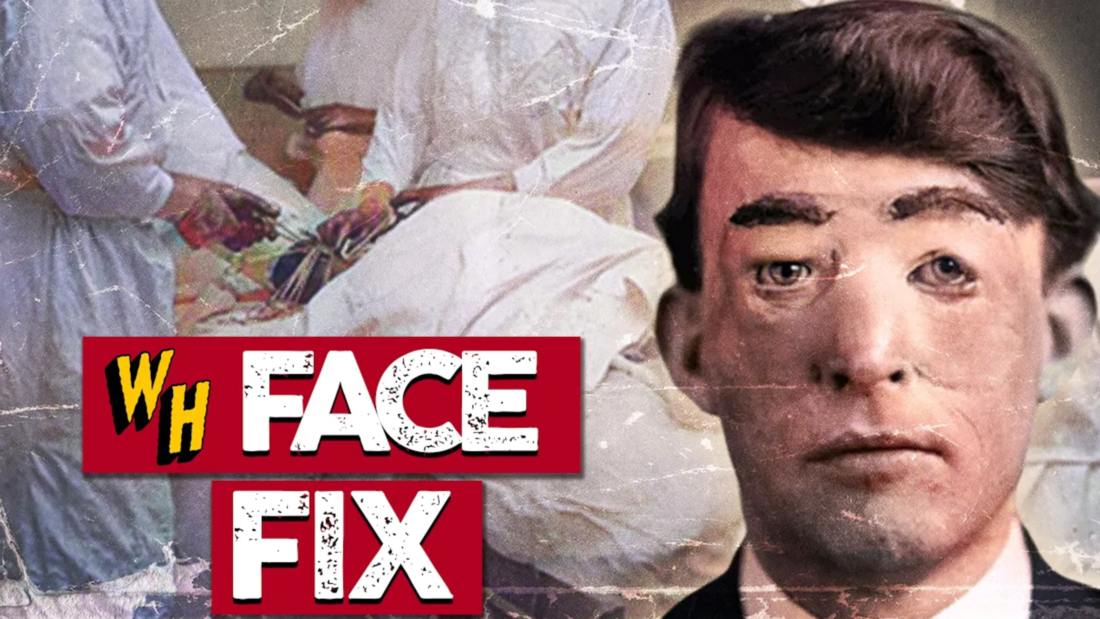 Video thumbnail for The Crazy True Story Of The First Plastic Surgery In History