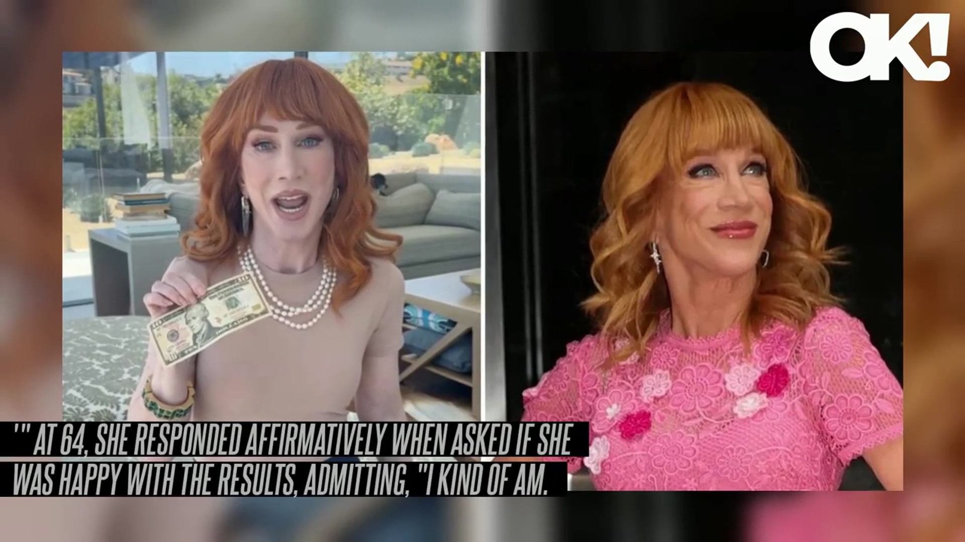 'Video thumbnail for Kathy Griffin Details 'Painful' Third Facelift, Reveals Doctor Took Fat From Her Thigh to Fill Out Her Cheeks:'