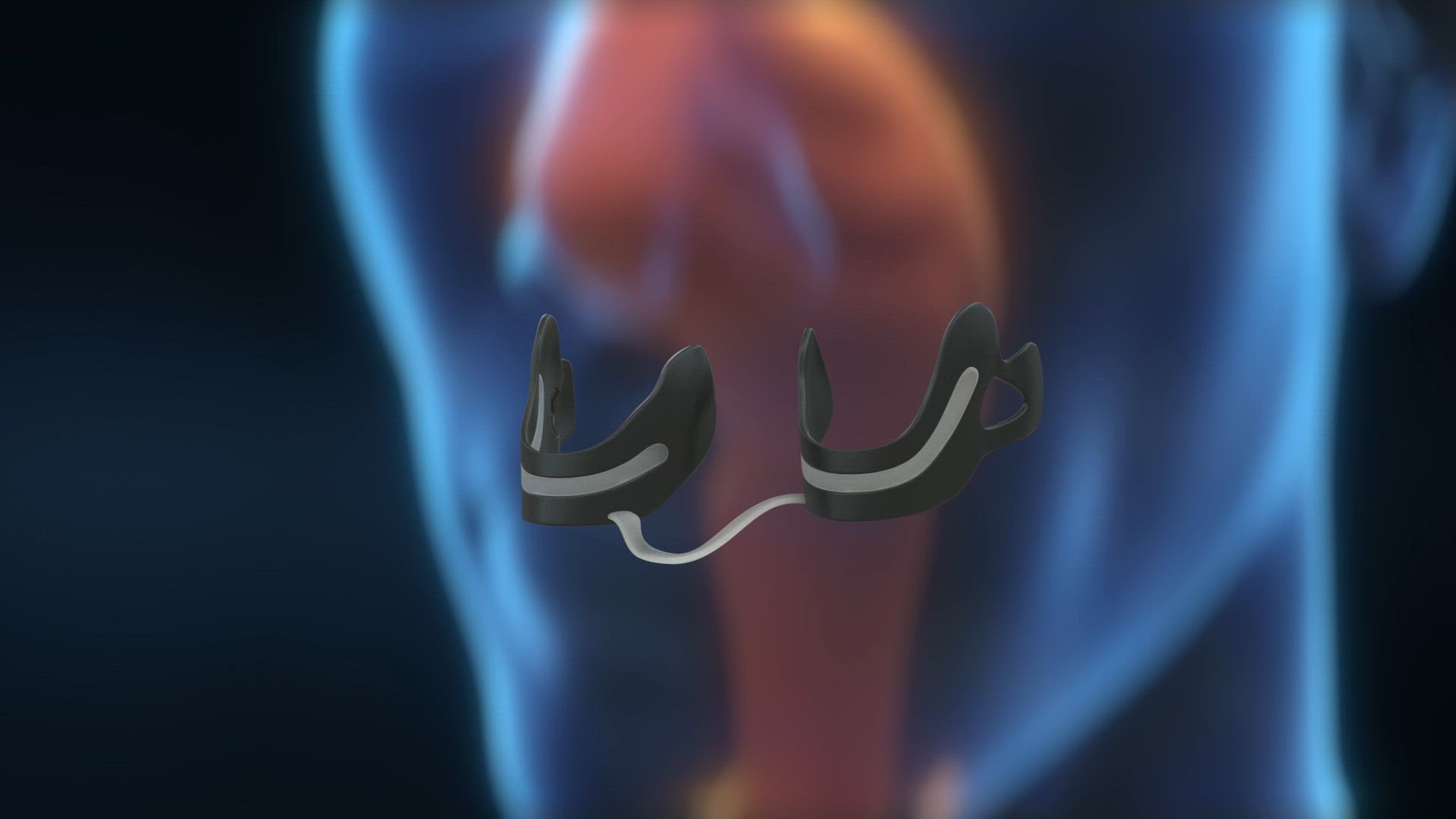 Video thumbnail for Easy Stop Snoring Cure