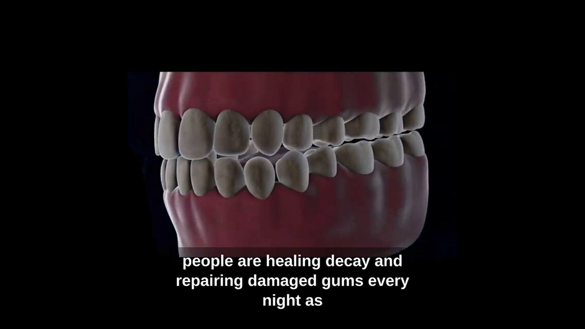 Video thumbnail for 1 Simple Secret Reverses Tooth Decay & Rebuilds Your Gums