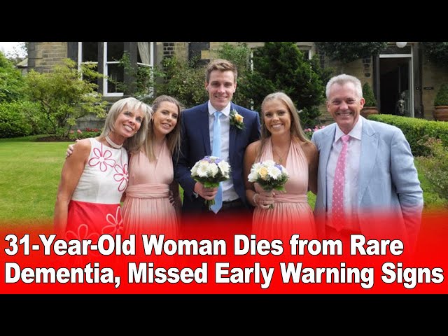 video of: 31-Year-Old Woman Dies from Rare Dementia, Siblings Share Early Warning Signs