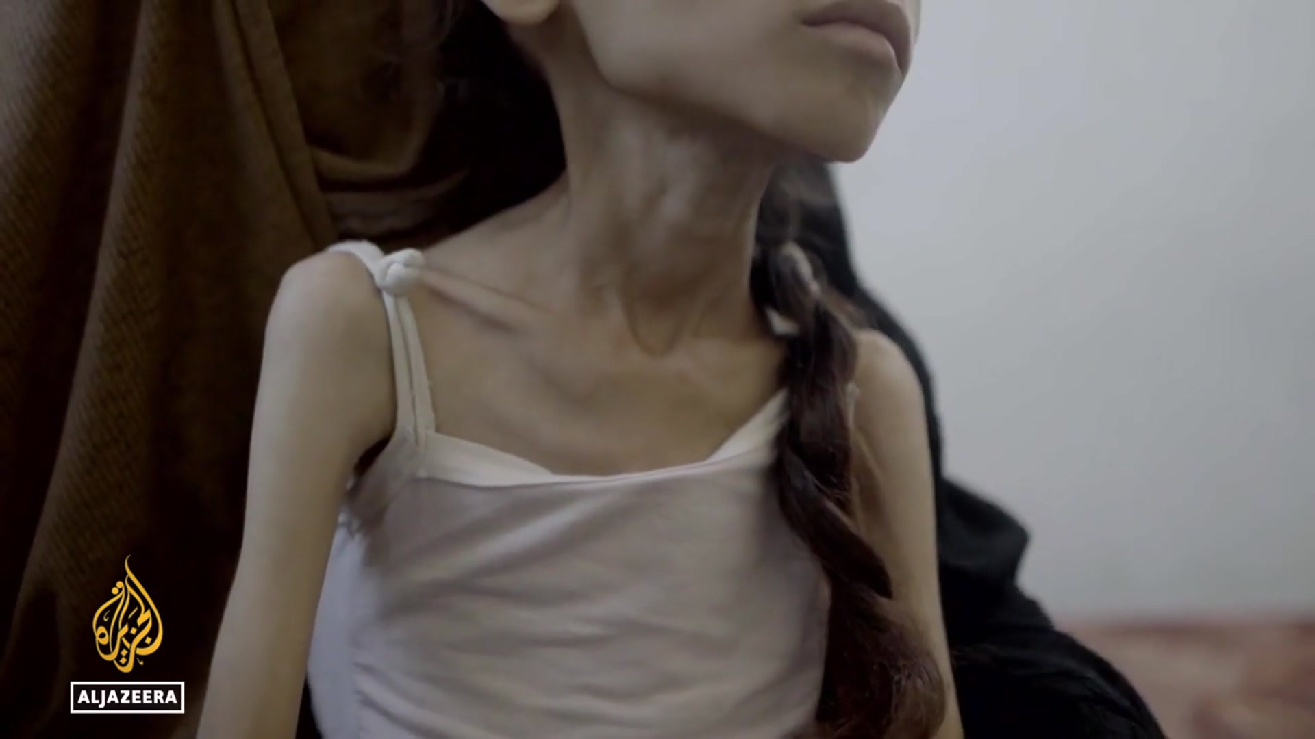 'Video thumbnail for Famine officially declared: Extreme malnutrition and hunger in Gaza city'