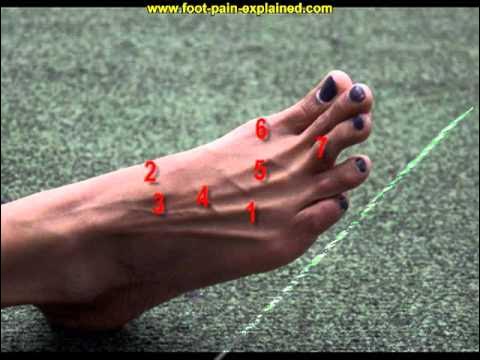 Video thumbnail for top of foot pain