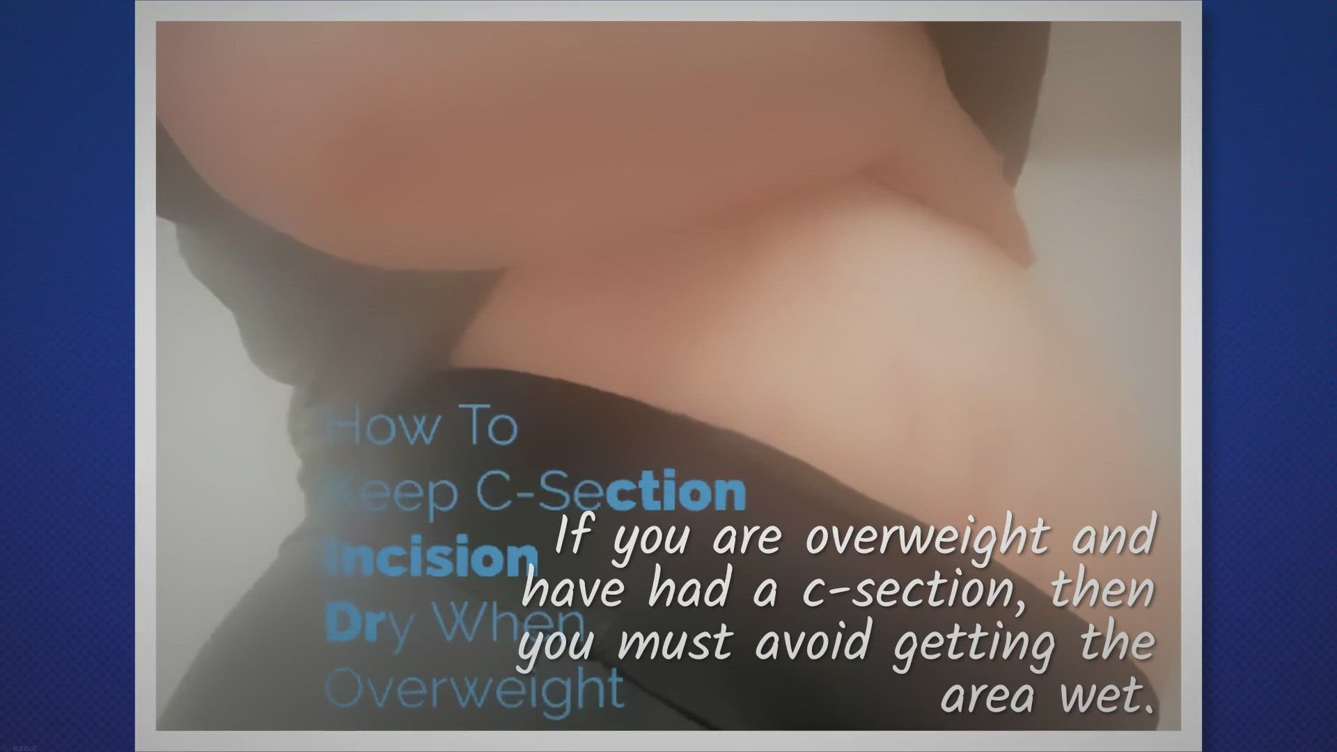 Video thumbnail for How To Keep C-Section Incision Dry When Overweight