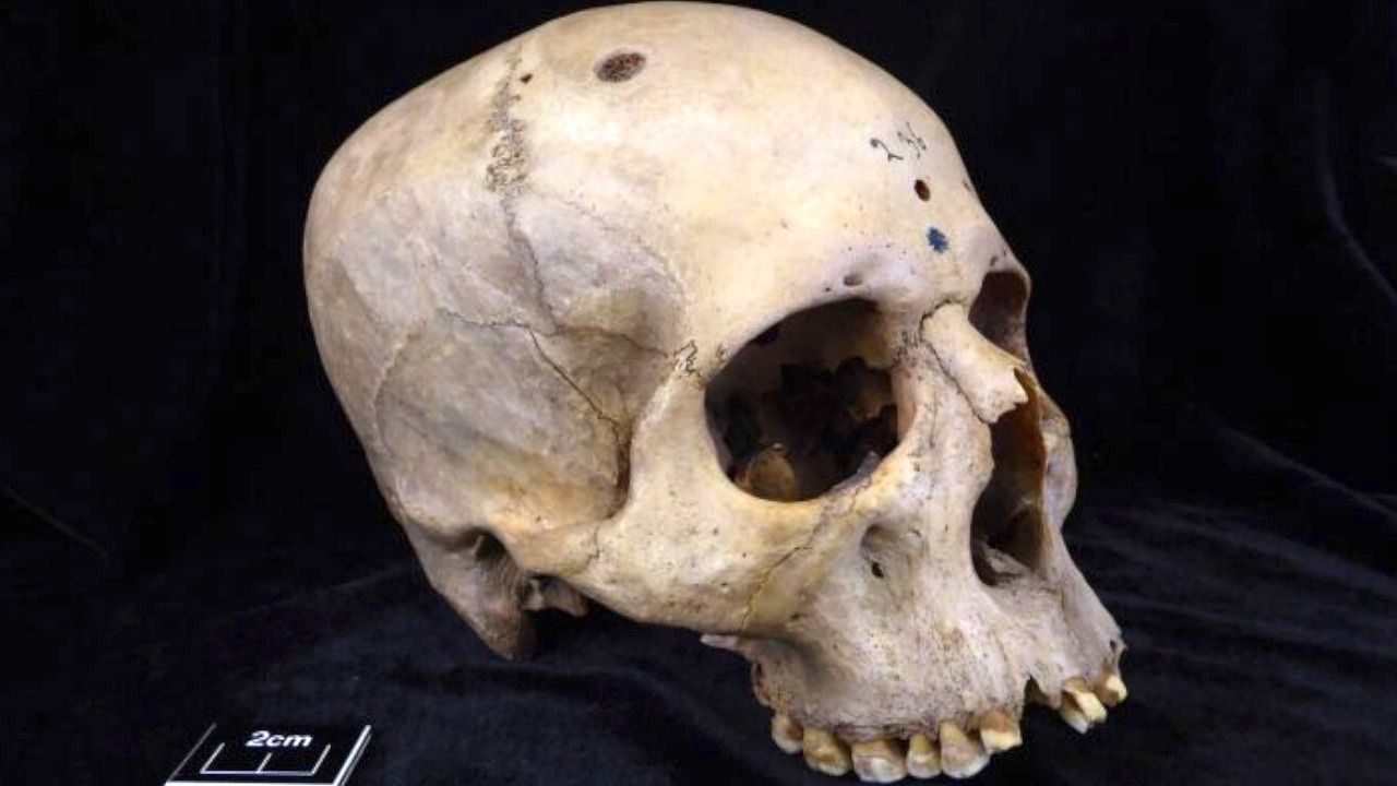 Video thumbnail for Clues suggest ancient Egyptians treated cancer millennia ago